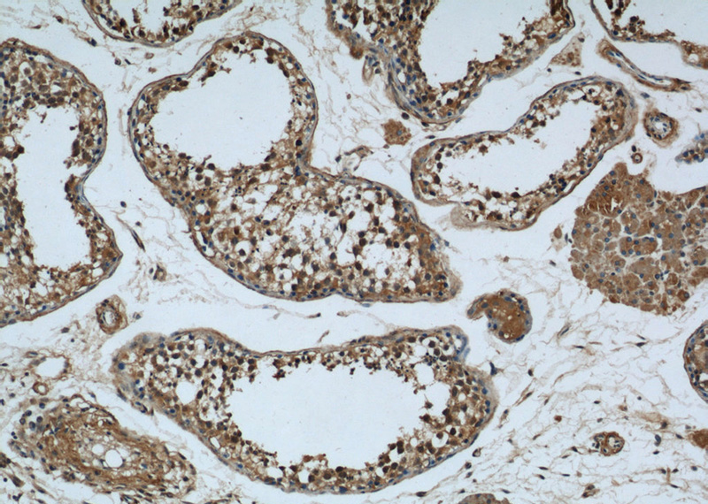 Immunohistochemical of paraffin-embedded human testis using Catalog No:114867(KIAA0226 antibody) at dilution of 1:50 (under 10x lens)