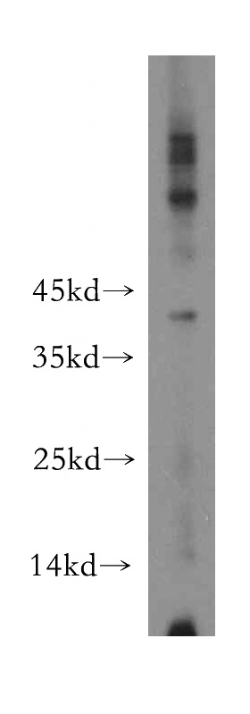 A549 cells were subjected to SDS PAGE followed by western blot with Catalog No:116718(VASH2 antibody) at dilution of 1:600
