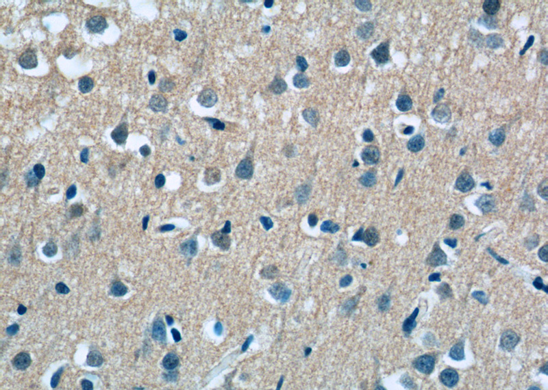 Immunohistochemistry of paraffin-embedded human brain tissue slide using Catalog No:108273(ASTN2 Antibody) at dilution of 1:50 (under 40x lens)