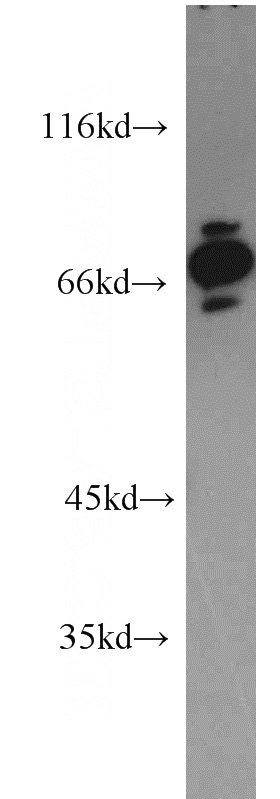 HeLa cells were subjected to SDS PAGE followed by western blot with Catalog No:108863(CARS antibody) at dilution of 1:1500