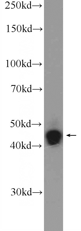 SH-SY5Y cells were subjected to SDS PAGE followed by western blot with Catalog No:116946(ZNF124 Antibody) at dilution of 1:2000