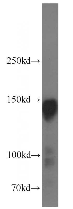 HeLa cells were subjected to SDS PAGE followed by western blot with Catalog No:108280(ATXN2 antibody) at dilution of 1:1000