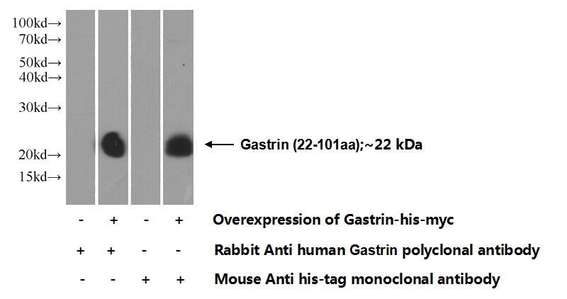 Transfected HEK-293 cells were subjected to SDS PAGE followed by western blot with Catalog No:110875(GAST Antibody) at dilution of 1:500