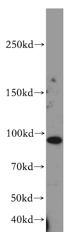 HeLa cells were subjected to SDS PAGE followed by western blot with Catalog No:112889(MUC16,CA125 antibody) at dilution of 1:300