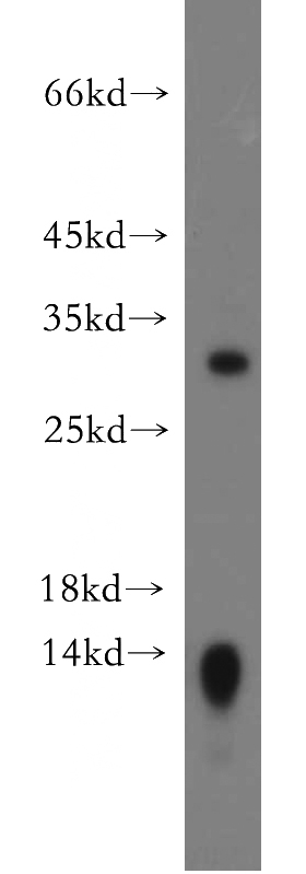 mouse kidney tissue were subjected to SDS PAGE followed by western blot with Catalog No:109338(CLDN18 antibody) at dilution of 1:500