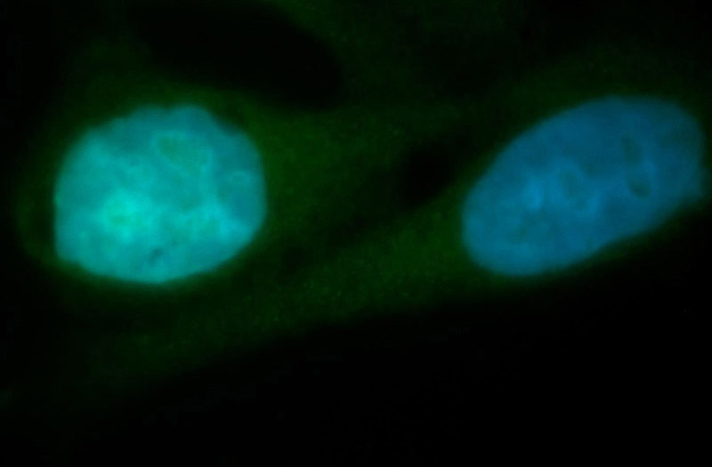 Immunofluorescent analysis of HepG2 cells, using CDK2 antibody Catalog No:109158 at 1:100 dilution and FITC-labeled donkey anti-rabbit IgG(green). Blue pseudocolor = DAPI (fluorescent DNA dye).