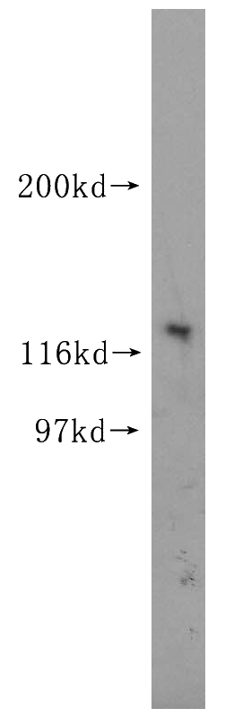 human brain tissue were subjected to SDS PAGE followed by western blot with Catalog No:113307(Notch1 antibody) at dilution of 1:500