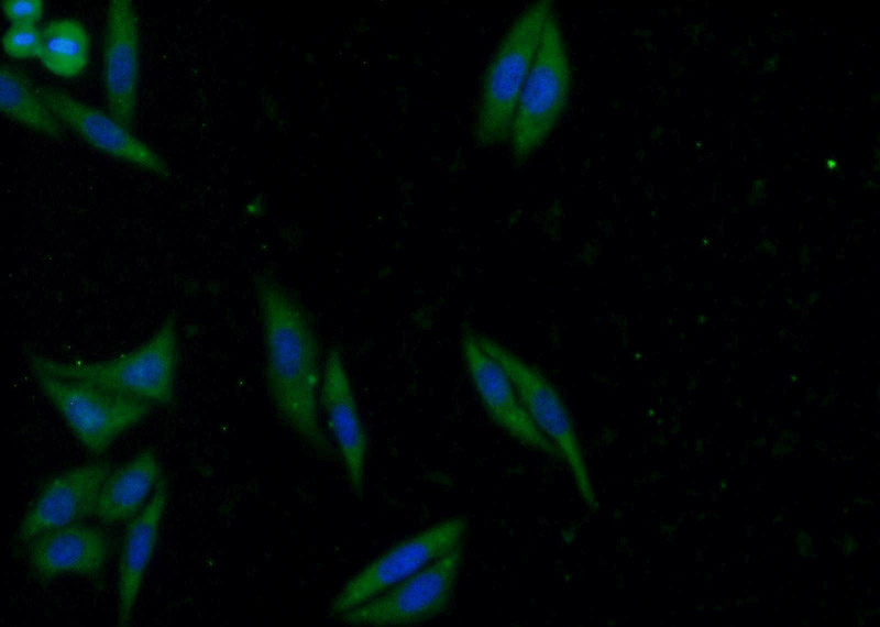 Immunofluorescent analysis of HepG2 cells using Catalog No:108294(ATG2B Antibody) at dilution of 1:25 and Alexa Fluor 488-congugated AffiniPure Goat Anti-Rabbit IgG(H+L)