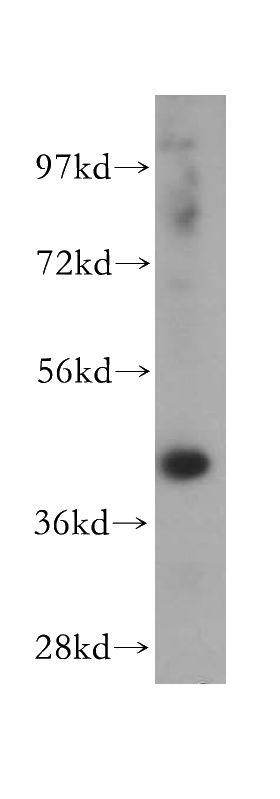 Jurkat cells were subjected to SDS PAGE followed by western blot with Catalog No:109292(CHST11 antibody) at dilution of 1:300