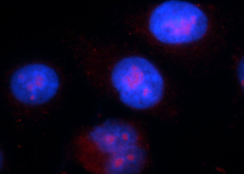Immunofluorescent analysis of HepG2 cells using Catalog No:109228(CHK1 Antibody) at dilution of 1:25 and Rhodamine-Goat anti-Rabbit IgG