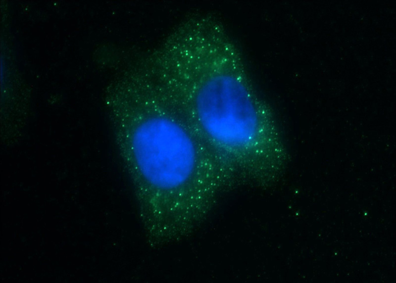 Immunofluorescent analysis of HepG2 cells using Catalog No:116955(ZNF184 Antibody) at dilution of 1:25 and Alexa Fluor 488-congugated AffiniPure Goat Anti-Rabbit IgG(H+L)