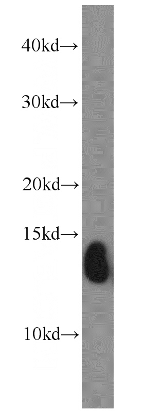 human placenta tissue were subjected to SDS PAGE followed by western blot with Catalog No:111288(HBE1 antibody) at dilution of 1:1000