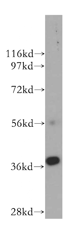 MCF7 cells were subjected to SDS PAGE followed by western blot with Catalog No:110407(ERCC1 antibody) at dilution of 1:300
