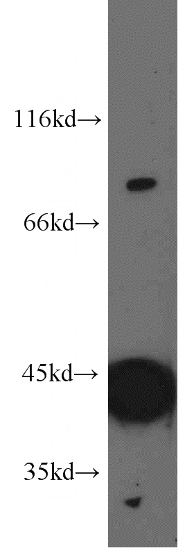 HEK-293 cells were subjected to SDS PAGE followed by western blot with Catalog No:115405(SMURF1 antibody) at dilution of 1:800