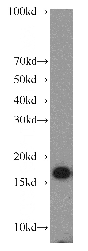 MCF7 cells were subjected to SDS PAGE followed by western blot with Catalog No:117310(COXIV antibody) at dilution of 1:1000