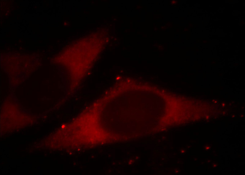 Immunofluorescent analysis of MCF-7 cells, using CTCFL antibody Catalog No: at 1:25 dilution and Rhodamine-labeled goat anti-mouse IgG (red).