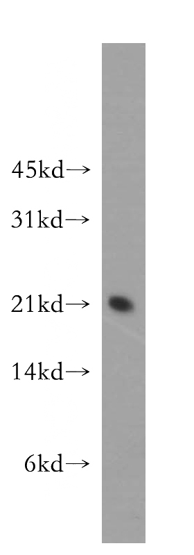 HeLa cells were subjected to SDS PAGE followed by western blot with Catalog No:115102(SELS antibody) at dilution of 1:500