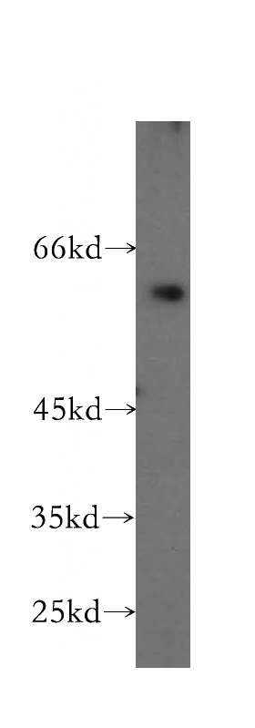 BxPC-3 cells were subjected to SDS PAGE followed by western blot with Catalog No:108998(CCKBR-specific antibody) at dilution of 1:300