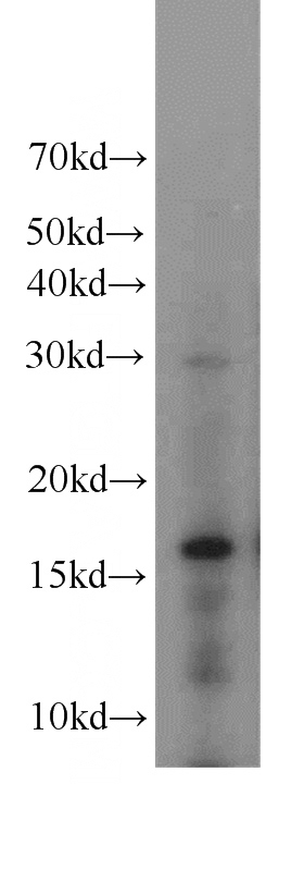 HEK-293 cells were subjected to SDS PAGE followed by western blot with Catalog No:111325(H3F3B antibody) at dilution of 1:300
