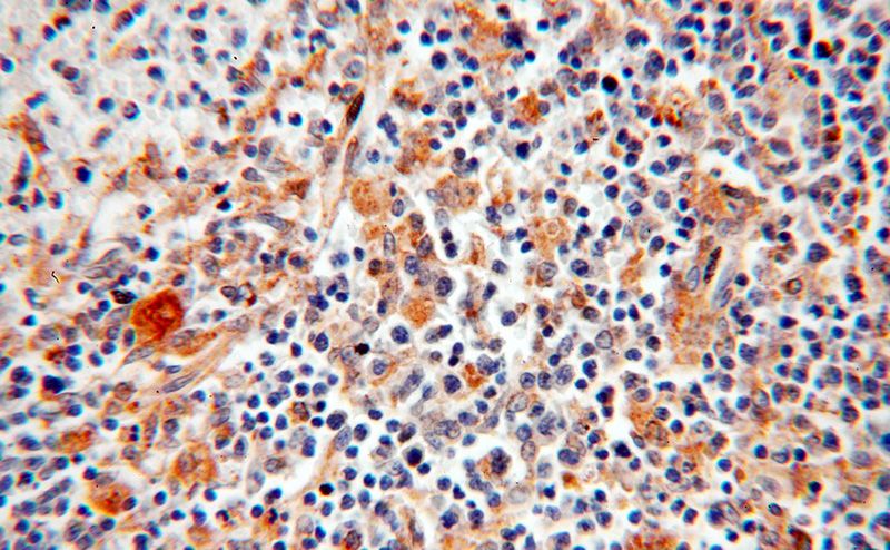 Immunohistochemical of paraffin-embedded human spleen using Catalog No:109986(DLC1 antibody) at dilution of 1:100 (under 40x lens)