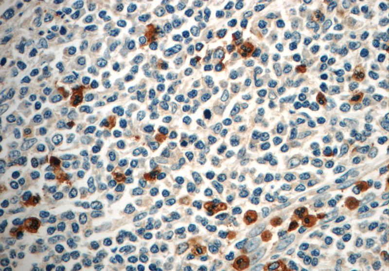 Immunohistochemistry of paraffin-embedded human tonsillitis slide using Catalog No:110601(FAM78A Antibody) at dilution of 1:50