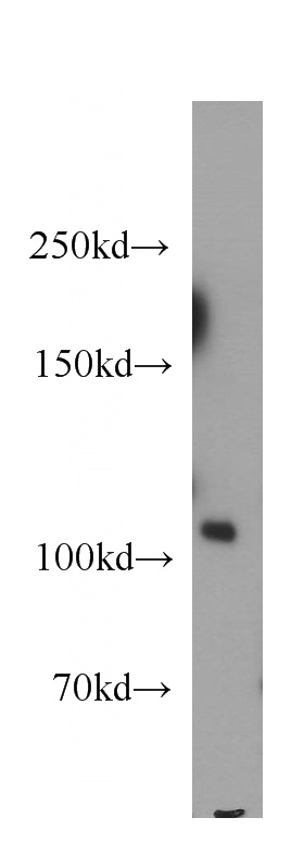 human brain tissue were subjected to SDS PAGE followed by western blot with Catalog No:113871(PIK3CA antibody) at dilution of 1:1000
