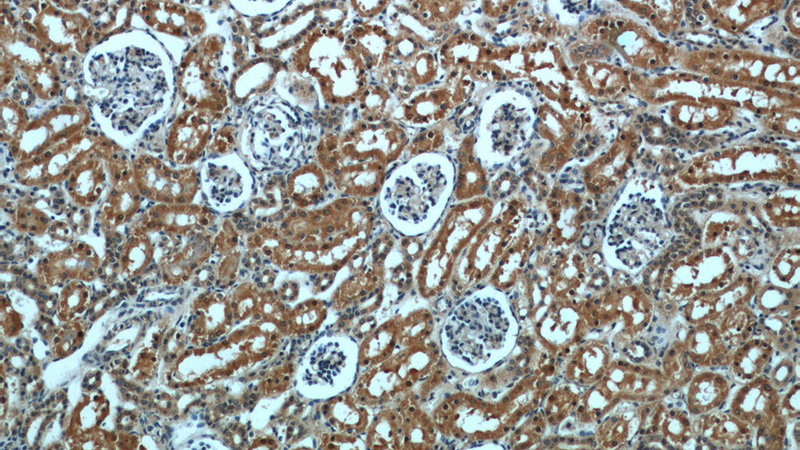 Immunohistochemical of paraffin-embedded human kidney using Catalog No:114467(RPTOR antibody) at dilution of 1:50 (under 10x lens)
