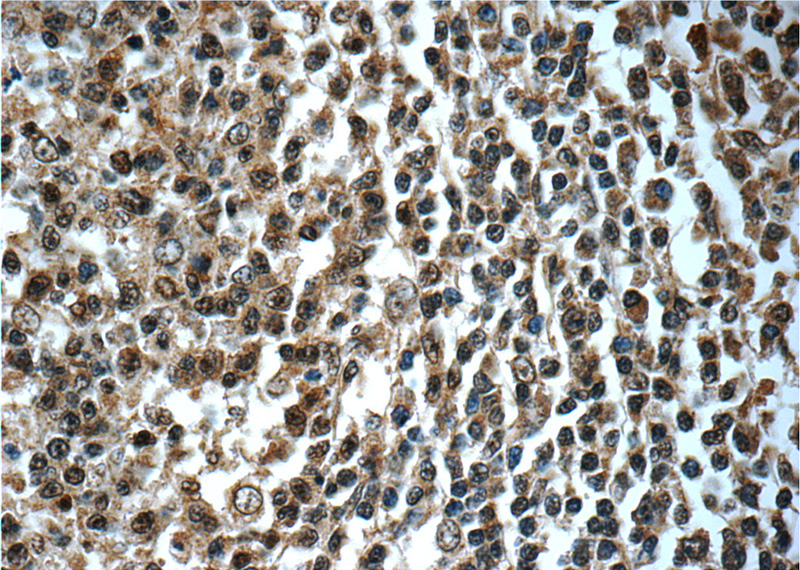 Immunohistochemistry of paraffin-embedded human tonsillitis tissue slide using Catalog No:115948(TERF2IP Antibody) at dilution of 1:50 (under 40x lens)