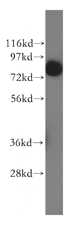 HepG2 cells were subjected to SDS PAGE followed by western blot with Catalog No:116069(TLE3 antibody) at dilution of 1:400