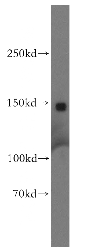 mouse pancreas tissue were subjected to SDS PAGE followed by western blot with Catalog No:107957(AOX1 antibody) at dilution of 1:300
