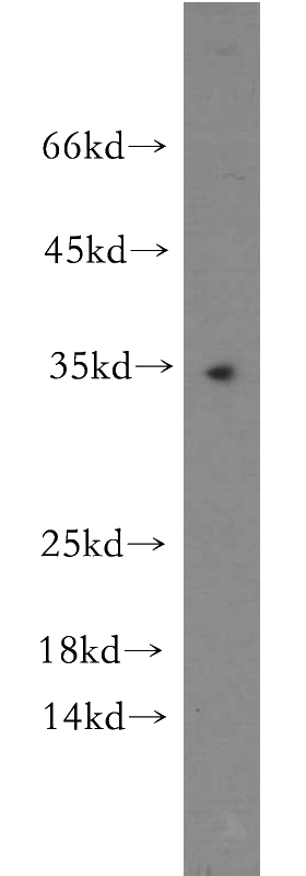 human testis tissue were subjected to SDS PAGE followed by western blot with Catalog No:113252(NMNAT1 antibody) at dilution of 1:500