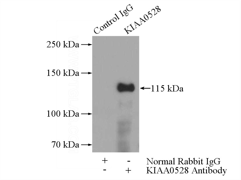 IP Result of anti-KIAA0528 (IP:Catalog No:111984, 4ug; Detection:Catalog No:111984 1:700) with HeLa cells lysate 520ug.
