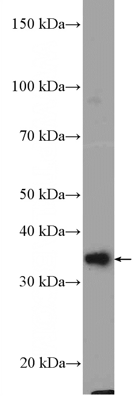 HepG2 cells were subjected to SDS PAGE followed by western blot with Catalog No:108961(CCDC109A Antibody) at dilution of 1:600