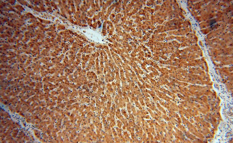 Immunohistochemical of paraffin-embedded human liver using Catalog No:115920(TCTN2 antibody) at dilution of 1:100 (under 10x lens)