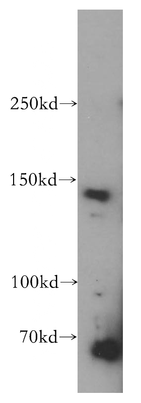 MCF7 cells were subjected to SDS PAGE followed by western blot with Catalog No:114048(POLR3A antibody) at dilution of 1:300