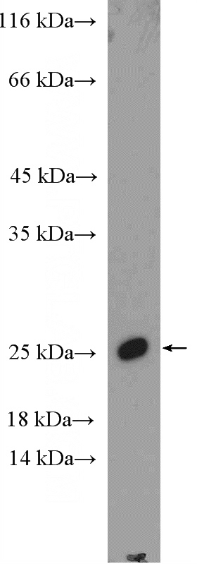 PC-3 cells were subjected to SDS PAGE followed by western blot with Catalog No:115617(SSX1 Antibody) at dilution of 1:300