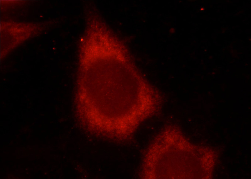 Immunofluorescent analysis of HeLa cells using Catalog No:115417(SMAD3 Antibody) at dilution of 1:25 and Rhodamine-Goat anti-Rabbit IgG