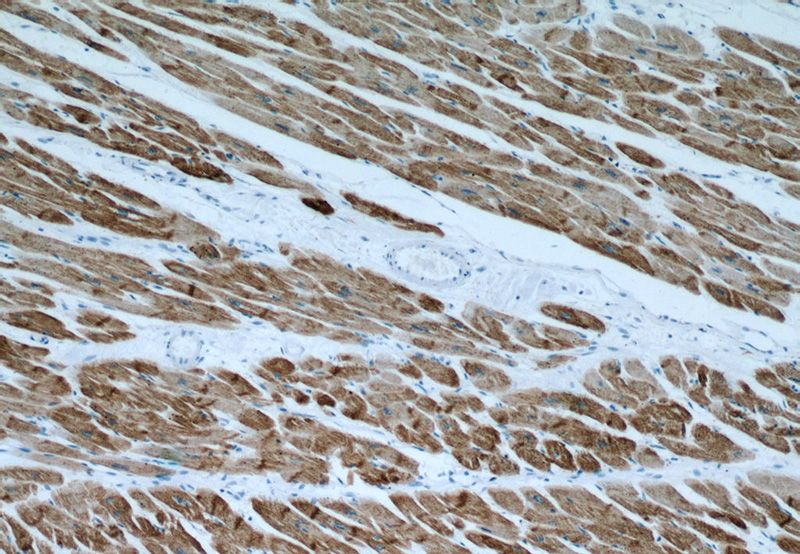 Immunohistochemical of paraffin-embedded human heart using Catalog No:107575(Actin-cardiac-muscle-1-Specific antibody) at dilution of 1:200 (under 10x lens)