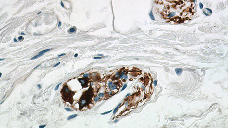 Immunohistochemistry of paraffin-embedded human colon tissue slide using Catalog No:107463(Peripherin Antibody) at dilution of 1:1000 (under 40x lens).