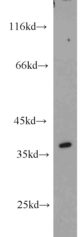 MCF7 cells were subjected to SDS PAGE followed by western blot with Catalog No:111549(HSD17B7 antibody) at dilution of 1:1000
