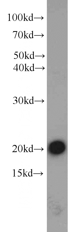 mouse brain tissue were subjected to SDS PAGE followed by western blot with Catalog No:109510(CPLX2 antibody) at dilution of 1:1000