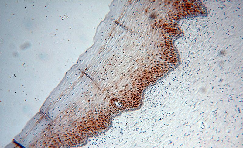 Immunohistochemical of paraffin-embedded human cervix using Catalog No:110841(Galectin-7 antibody) at dilution of 1:100 (under 10x lens)