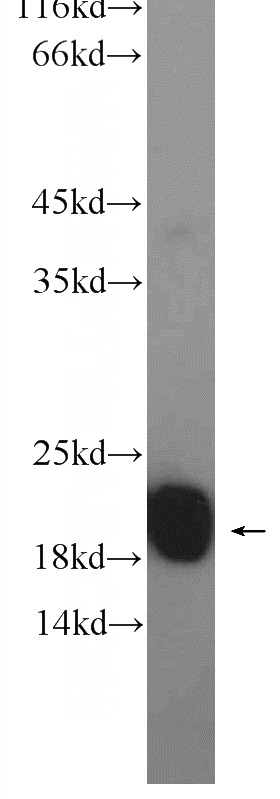 mouse brain tissue were subjected to SDS PAGE followed by western blot with Catalog No:113048(FREQ Antibody) at dilution of 1:2000