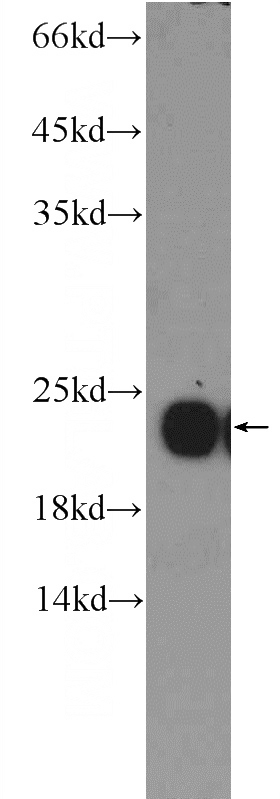HeLa cells were subjected to SDS PAGE followed by western blot with Catalog No:113721(PRDX2 Antibody) at dilution of 1:1000