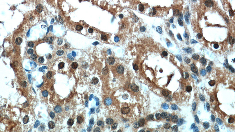 Immunohistochemical of paraffin-embedded human kidney using Catalog No:108678(C1orf50 antibody) at dilution of 1:50 (under 40x lens)