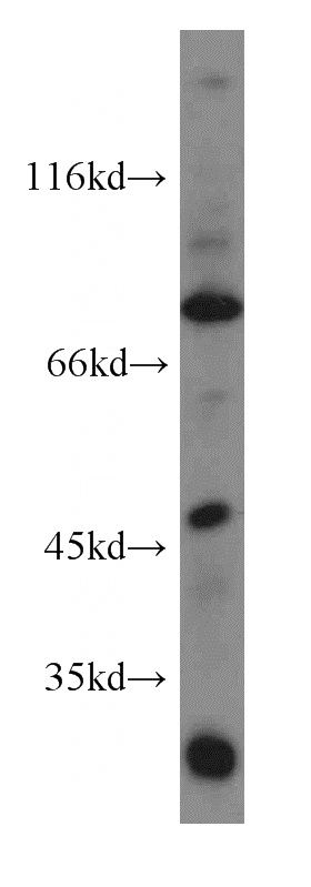Jurkat cells were subjected to SDS PAGE followed by western blot with Catalog No:107724(ACAP1 antibody) at dilution of 1:500