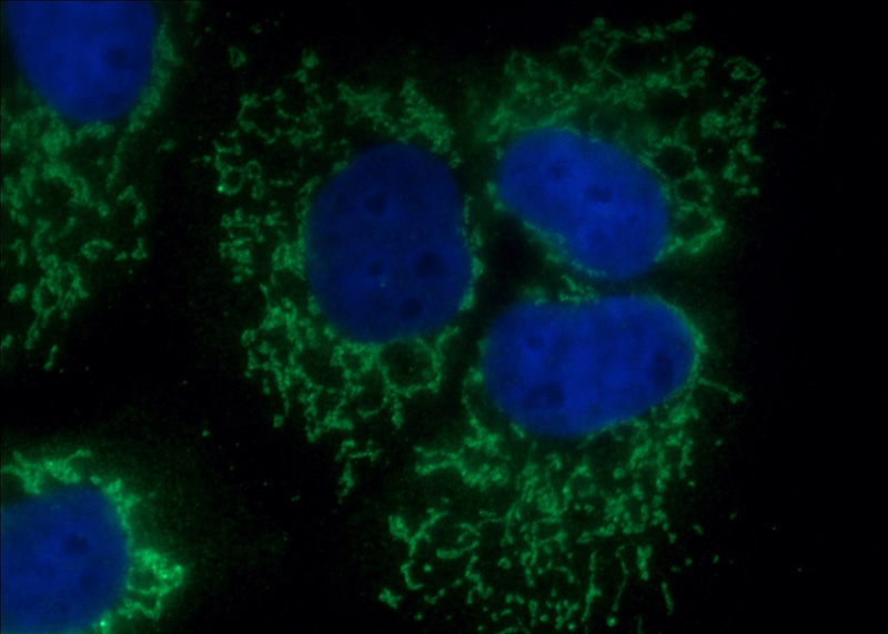 Immunofluorescent analysis of A431 cells using Catalog No:109871(DAXX Antibody) at dilution of 1:50 and Alexa Fluor 488-congugated AffiniPure Goat Anti-Rabbit IgG(H+L)