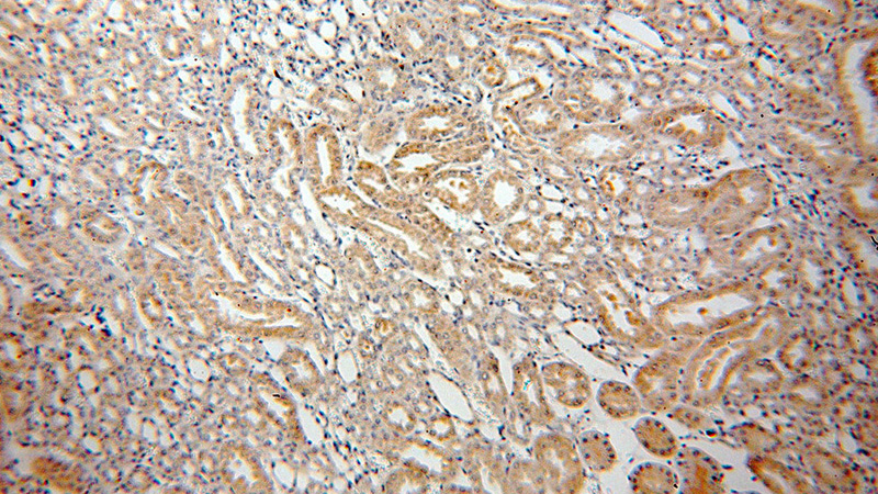 Immunohistochemical of paraffin-embedded human kidney using Catalog No:109312(CIB4 antibody) at dilution of 1:50 (under 10x lens)