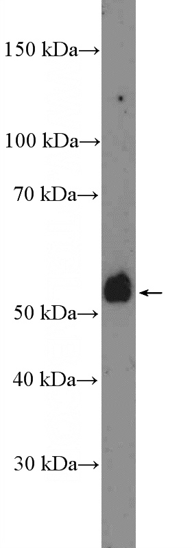 SW 1990 cells were subjected to SDS PAGE followed by western blot with Catalog No:116276(TMPRSS4 Antibody) at dilution of 1:1000