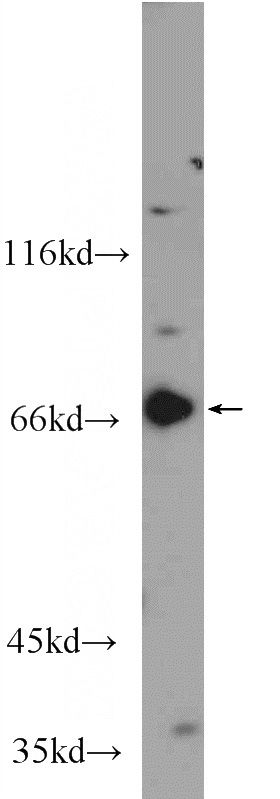 HEK-293 cells were subjected to SDS PAGE followed by western blot with Catalog No:111072(GPR107 Antibody) at dilution of 1:600